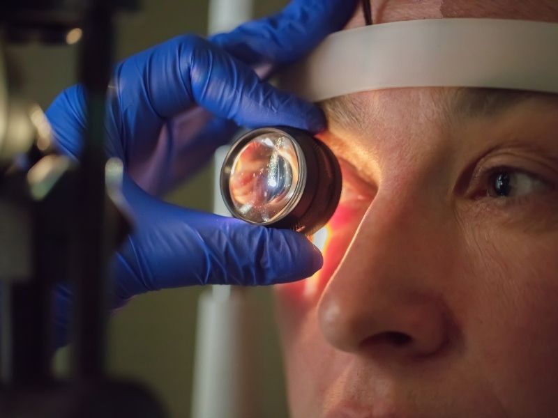 Katarakt tanısı görseli